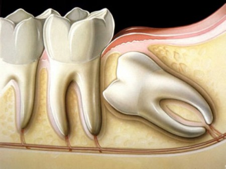 Cirurgia